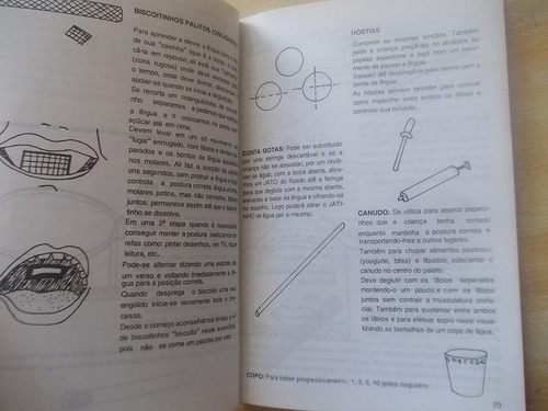 Livro Deglutição Atípica - C. H. Agustoni - Reeducação