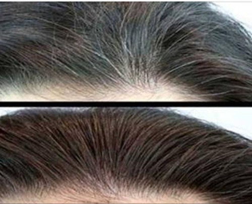 Shampoo Tônico Escurecedor Grisalho / Branco Unissex Troia