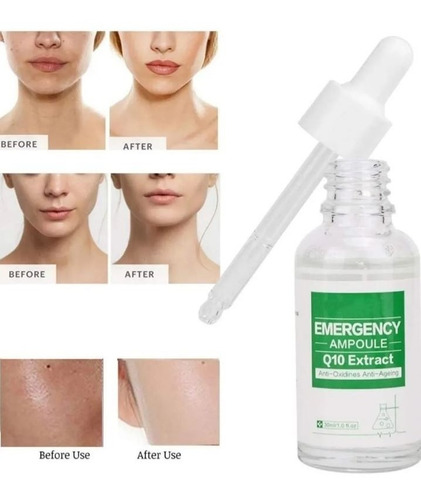 Serum Q10 Extracto Facial Hidratante Rejuvenece Antiarrugas Tipo de piel TodoTipoPiel