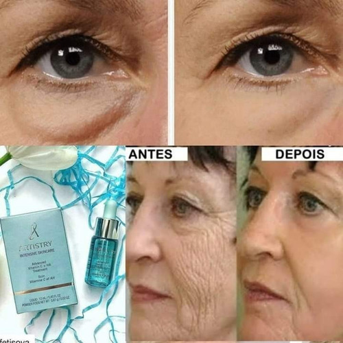 Artistry Vitamina C Ácido Hialurônico Reduz Linhas Expressão Tipo De Pele Qualquer