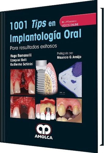 1001 Tips En Implantologia Oral Romanelli