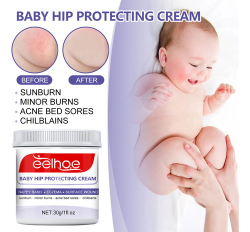 . Crema Cicatrizante Antiséptica Sudocrem Cool 30g
