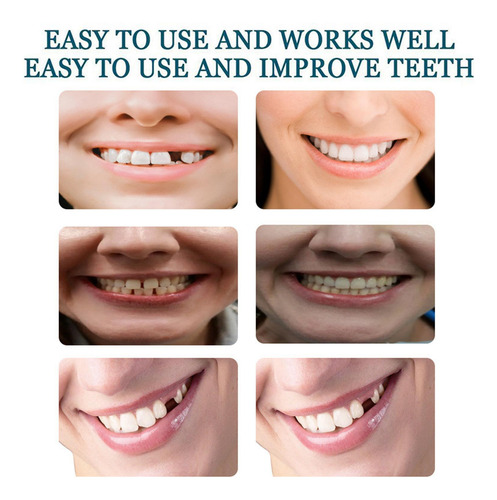 Diente Temporal Carillas Dentales Desmontables Y Reutilizabl