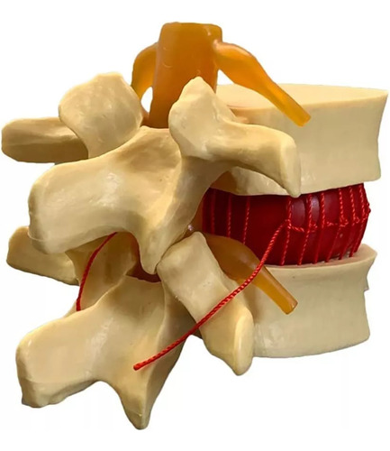 Anatomía Disco Lumbar Columna Vertebral Modelo Enseñando2024