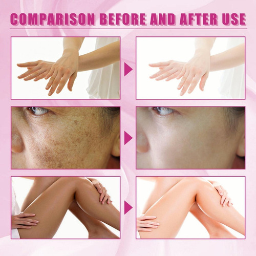 3×aceite Exfoliante For Nudillos Q Extra Strength Color Amar