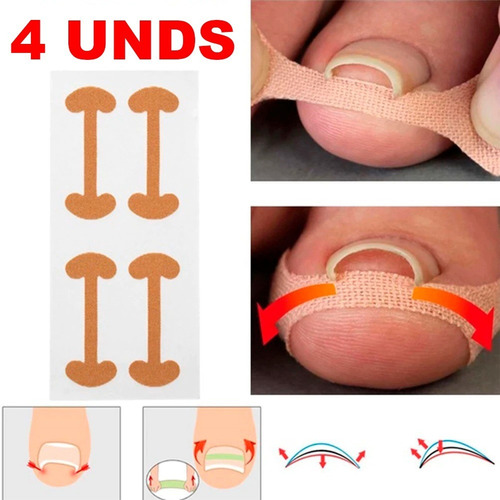 Corrector Adhesivo Uñas Encarnadas Cuidado De Uñeros X4 Unds