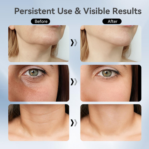 Masajeador Facial Para Cuello, Masajeador Facial Portátil 3