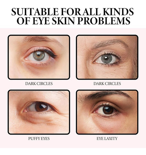 Creme Para Os Olhos Creme Eficaz Para Linhas Creme Para Olho