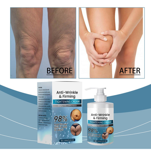 Firm Tighten Skin Cream, Loção Firmadora E Envelhecimento Pa