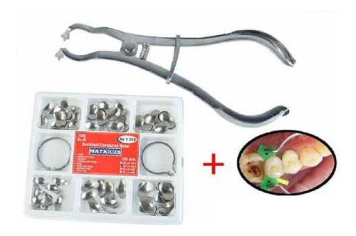 Imagen 2 de 6 de Banda Matrices Preformadas Odontología Anillo 100u Santiago