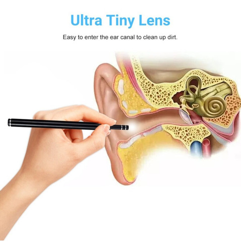 Limpiador De Oídos Cámara Hd Endoscopio App Accesorios