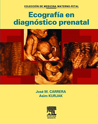 Libro Ecografia En Diagnostico Prenatal De Jose M. Carrera,