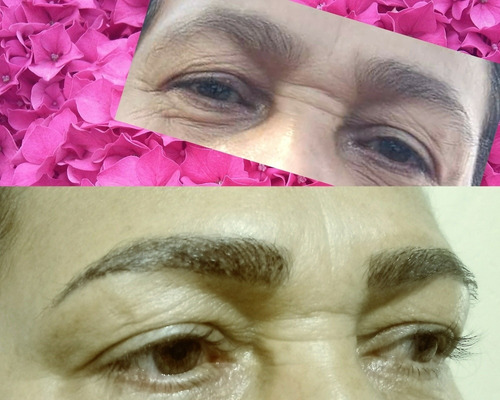 Imagem 3 de 4 de Micropigmentação De Lábios E Sobrancelhas