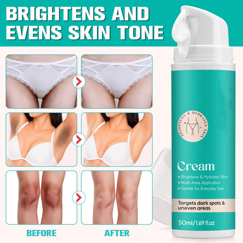 Crema Blanqueadora E Skin Para Axilas, Rodillas, Codos Y Mus