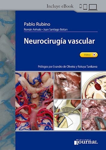 Neurocirugia Vascular - Incluye Ebook. Rubino