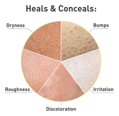 Crema Exfoliante Para Piel Áspera Keratosis Pilaris Procure,