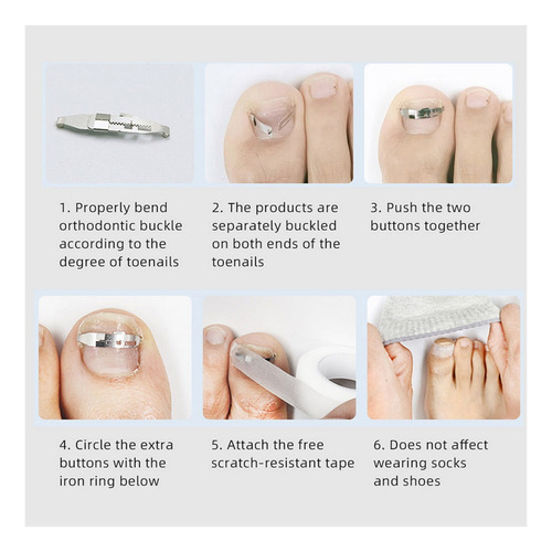 Kit De Herramientas Para Uñas Encarnadas Tratamiento De Uñas