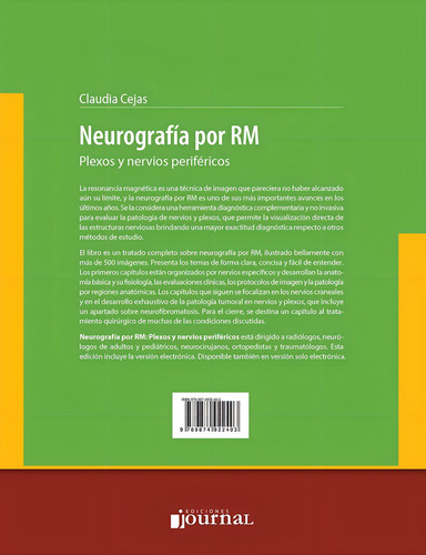Neurografía Por Rm Claudia Cejas Envíos A Todo El País