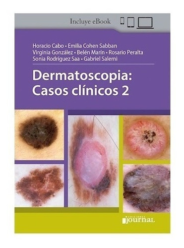 Dermatoscopia Casos Clínicos 2 Cabo Cohen Sabban