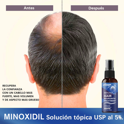 Spray Minoxidil 5% Crecimiento Sérum Para Cabello Y Barba