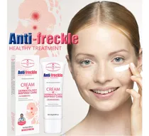 Comprar Crema Facial Anti-manchas Aichunbeauty 20g Quita Manchas