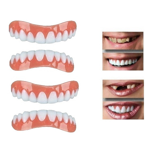 Paquete De 2 Dientes Falsos Profesionales De Silicona Bright