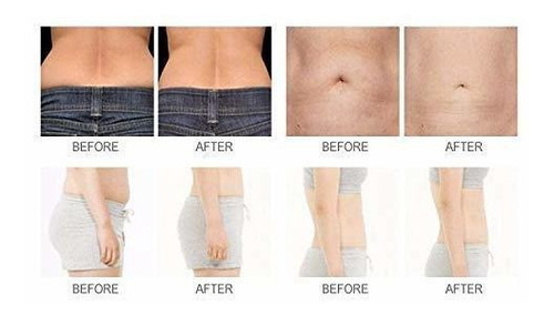 Dia Protable 650nm Liposuccion Lipolaser Lipo Laser Cuerpo