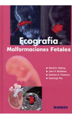 Libro - Ecografia Malformaciones Fetales Flexilibro - Nyber