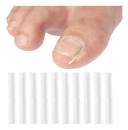 . Profesional For Uñas Encarnadas Reparación De Uñas