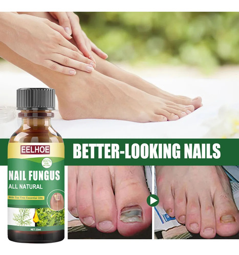 Esmalte De Uñas 3toe: Solución Para El Cuidado De Hongos-