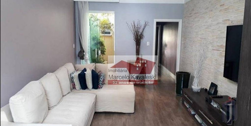 Sobrado Com 4 Dormitórios À Venda, 155 M² Por R$ 899.000,00 - Ipiranga - São Paulo/sp - So3314
