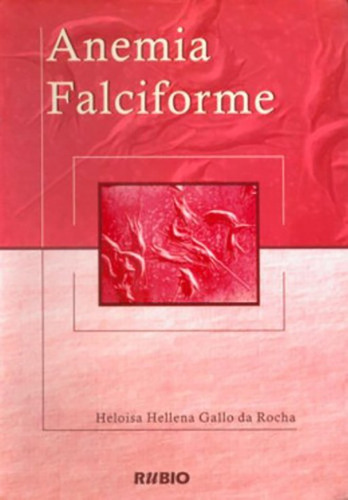 Anemia Falciforme