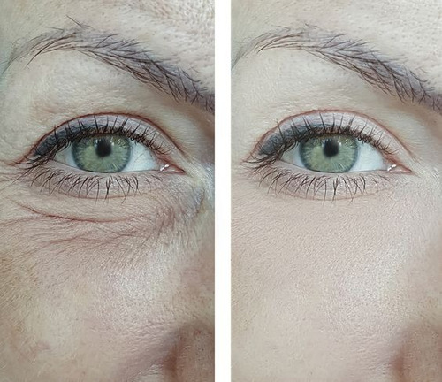 Crema Anti-age/retinol/ácido Hialurónico/+ 6 Aceites Puros