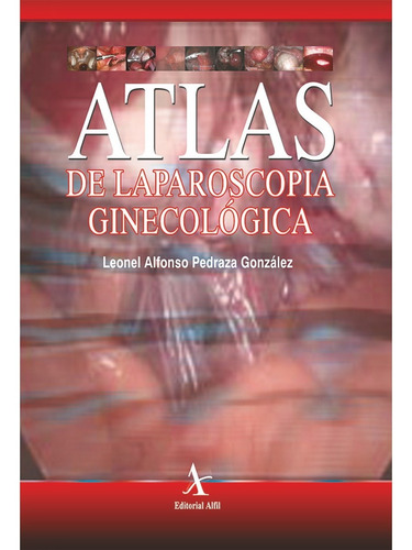 Atlas De Laparoscopia Ginecológica