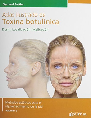 Atlas Ilustrado De Toxina Botulinica - Sattler, Gerhard