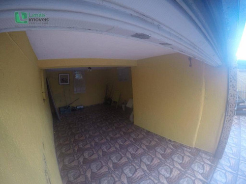 Imagem 3 de 30 de Casa Residencial À Venda, Limão, São Paulo. - Ca0284