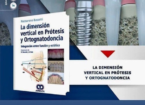 Libro - La Dimensión Vertical En Prótesis Y Ortognatodoncia