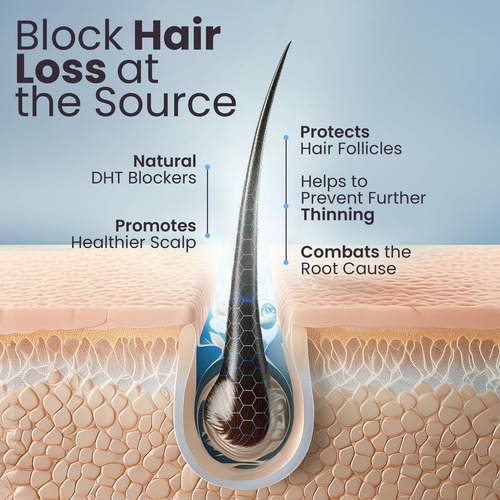 Espuma Para El Crecimiento Del Cabello Growplex Vitafoam 5%
