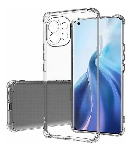 Carcasa Transparente Para Xiaomi Mi 11 Lite 5g Ne