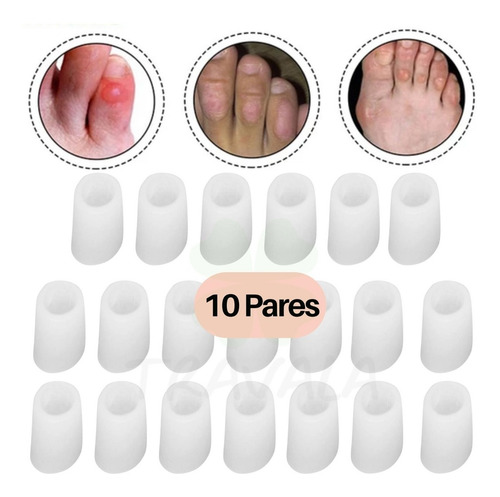 Imagem 2 de 7 de Kit 20 Protetores Para Os Dedos Do Pé Em Silicone Anti Calos