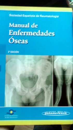 Manual De Enfermedades Oseas (2 Edicion)  Original