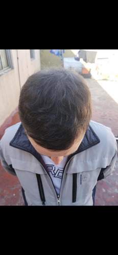 Shampoo Y Acondicionador Tratamiento Anticaida