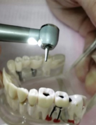 Imagen 6 de 6 de Turbina Dental Led Push 4 Spray Mejorada Midwest Santiago