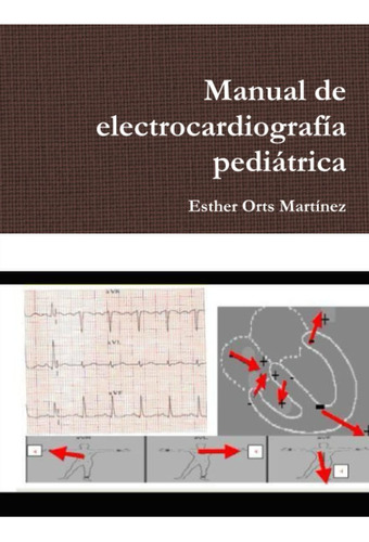 Libro: Manual Electrocardiografía Pediátrica (spanish Edi