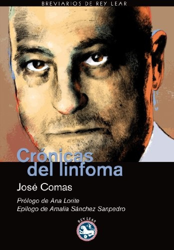 Cronicas Del Linfoma, De Jose  Comas. Editorial Rey Lear, Edición 1 En Español