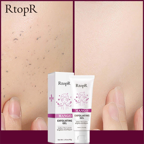 Gel Exfoliante P, Exfoliante Facial, 3003