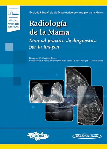 Radiología de la Mama Manual práctico de diagnóstico por la imagen Editorial Médica Panamericana 2022