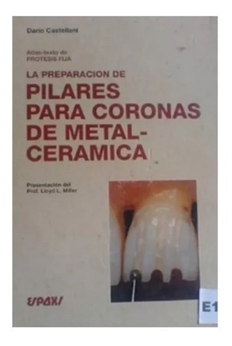 Preparacion Pilares Coronas Metal Ceramica Atlas Y Texto E16
