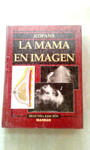 La Mama En Imagen Kopans Por Marban