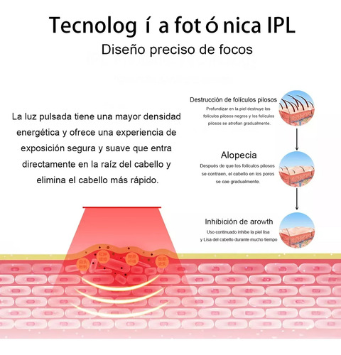 Depiladora Láser Ipl Luz Pulsada Reducción De Vello Hogar